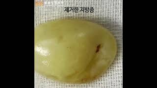 갑자기 내 몸에 혹이 생겼다?!