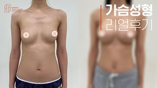 어제는 A컵가슴, 오늘부터 D컵 가슴으로 살아간다면?!