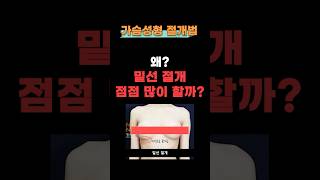 가슴성형, 밑선 절개 많이 하는 이유는?
